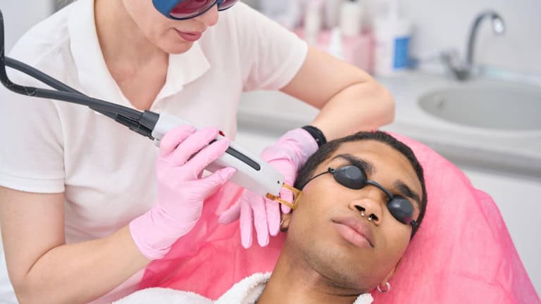 A person receiving laser hair removal on their face while wearing protective goggles.